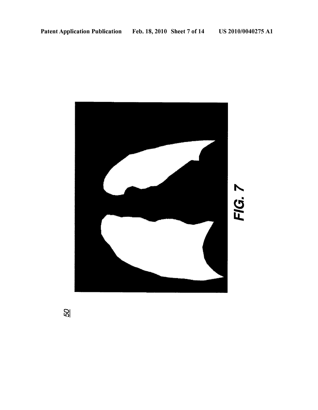 METHOD FOR DETECTING ANATOMICAL STRUCTURES - diagram, schematic, and image 08