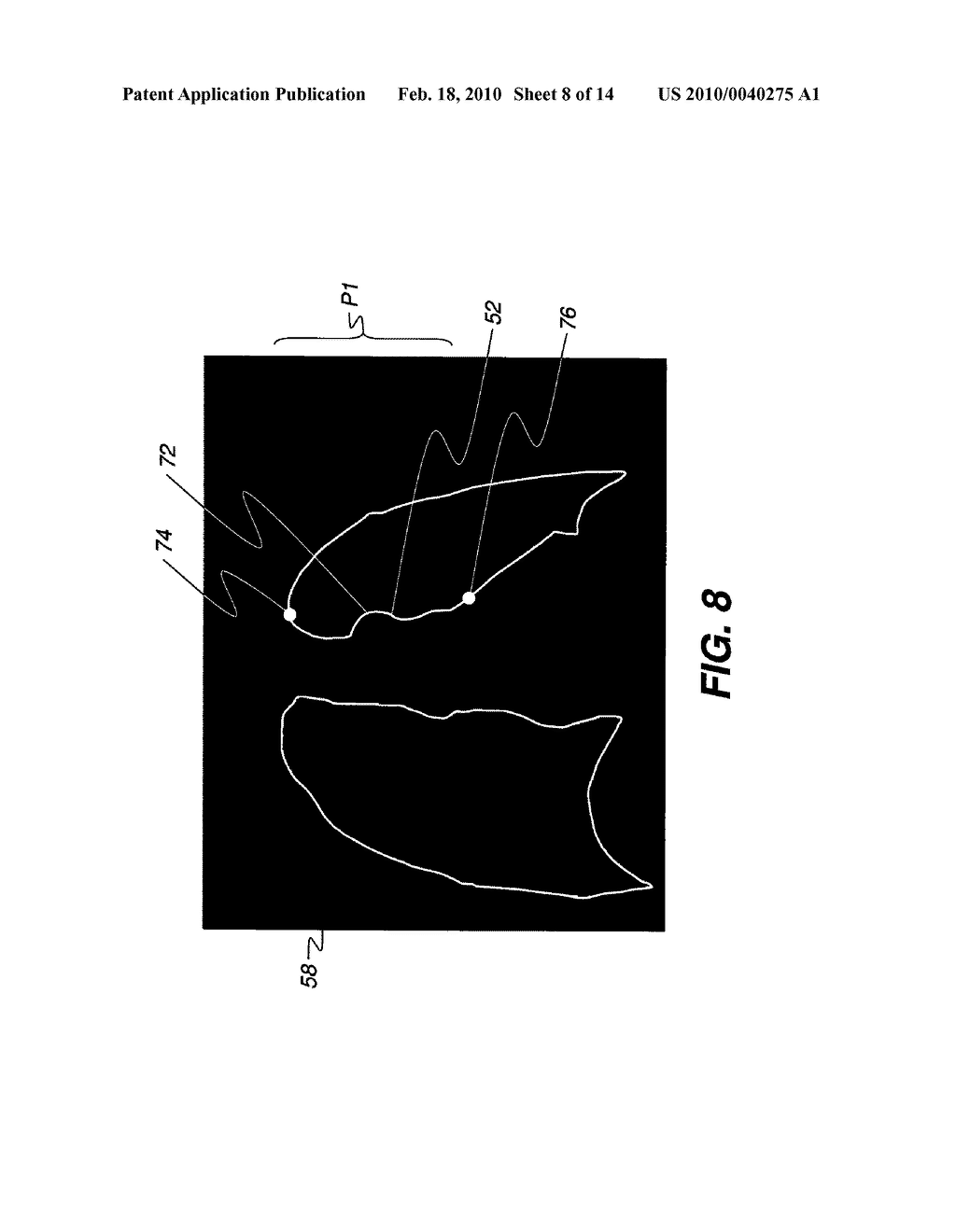 METHOD FOR DETECTING ANATOMICAL STRUCTURES - diagram, schematic, and image 09