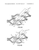 Animal Model of Central Neuropathic Pain and Methods of Making and Using the Same diagram and image