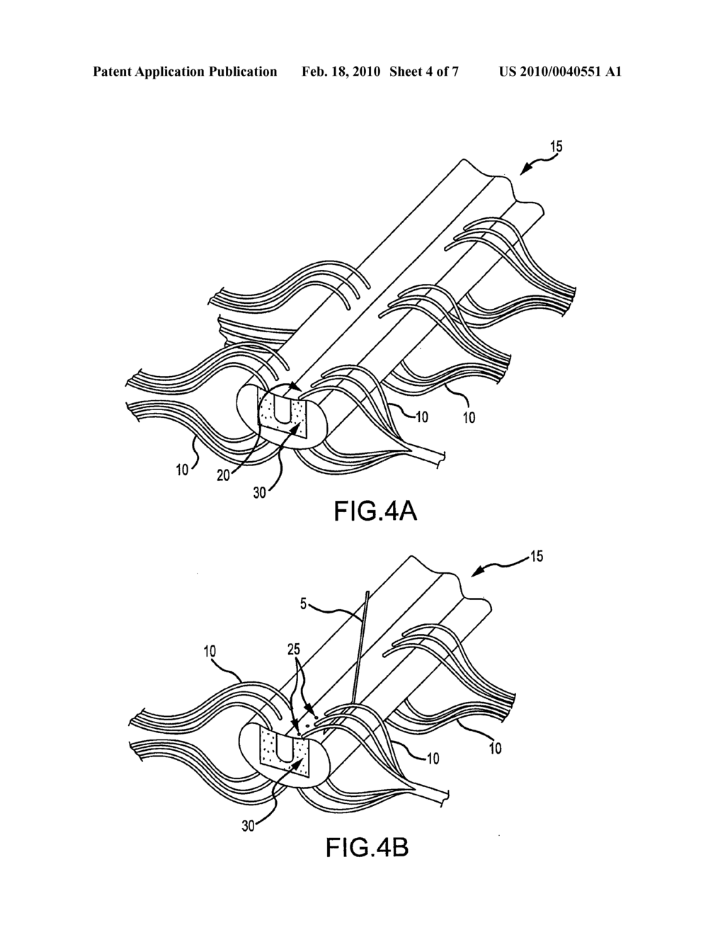 Animal Model of Central Neuropathic Pain and Methods of Making and Using the Same - diagram, schematic, and image 05