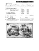 FORMULATIONS FOR NONSURGICAL EXOGENOUS CROSSLINK THERAPY diagram and image