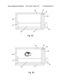 Tissue-mimicking phantom for prostate cancer brachytherapy diagram and image