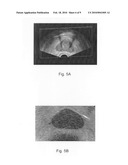 Tissue-mimicking phantom for prostate cancer brachytherapy diagram and image