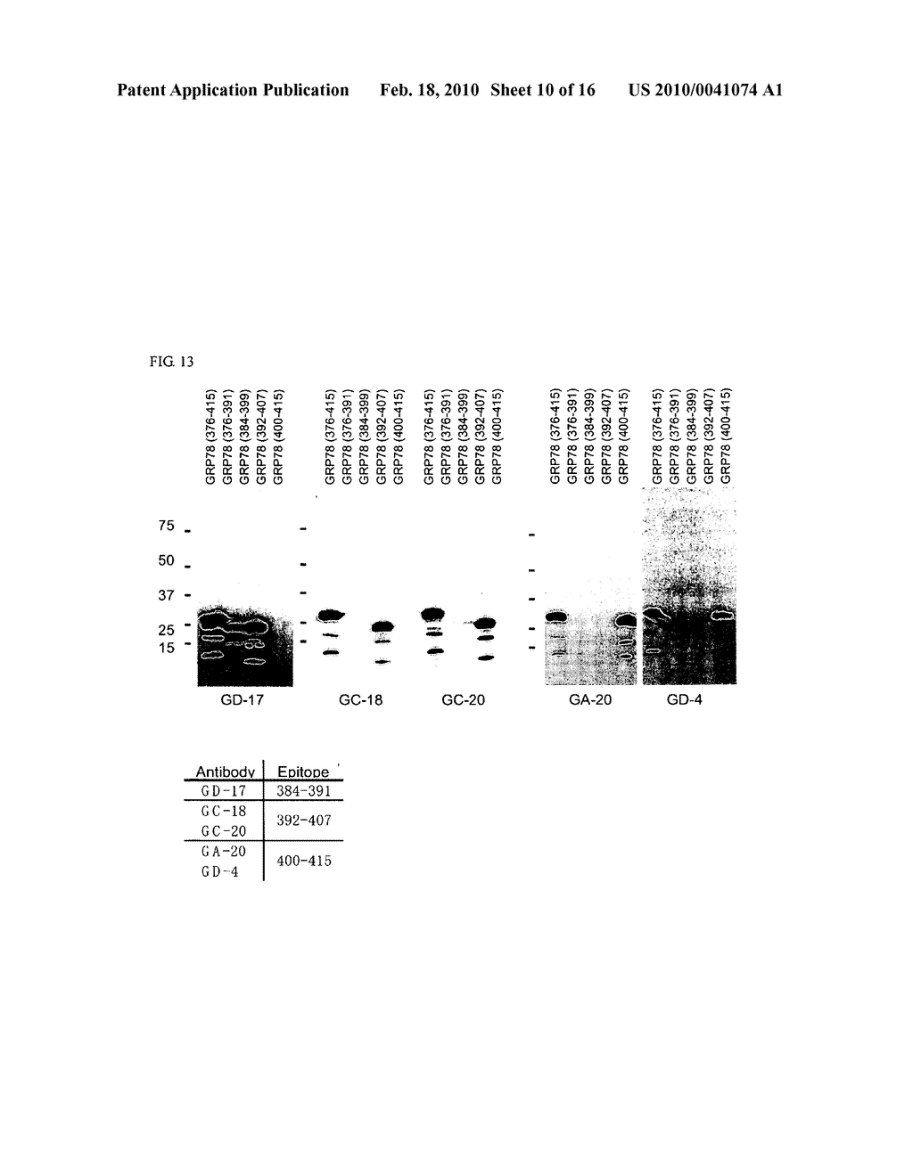 PHARMACEUTICAL COMPOSITION COMPRISING ANTI-GRP78 ANTIBODY AS ACTIVE INGREDIENT - diagram, schematic, and image 11