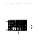 EXPRESSION SYSTEM FOR RECOMBINANT HUMAN ARGINASE I diagram and image