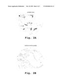 METHODS FOR DIAGNOSING AND TREATING PROSTATE CANCER diagram and image