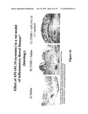 INTERLEUKIN-1 RECEPTOR ANTAGONISTS, COMPOSITIONS, AND METHODS OF TREATMENT diagram and image