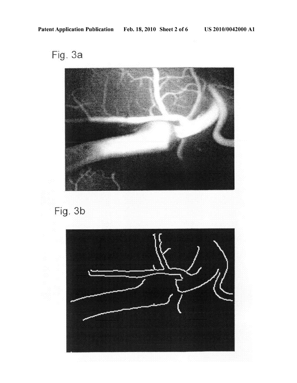 Method for correcting the image data that represent the blood flow - diagram, schematic, and image 03