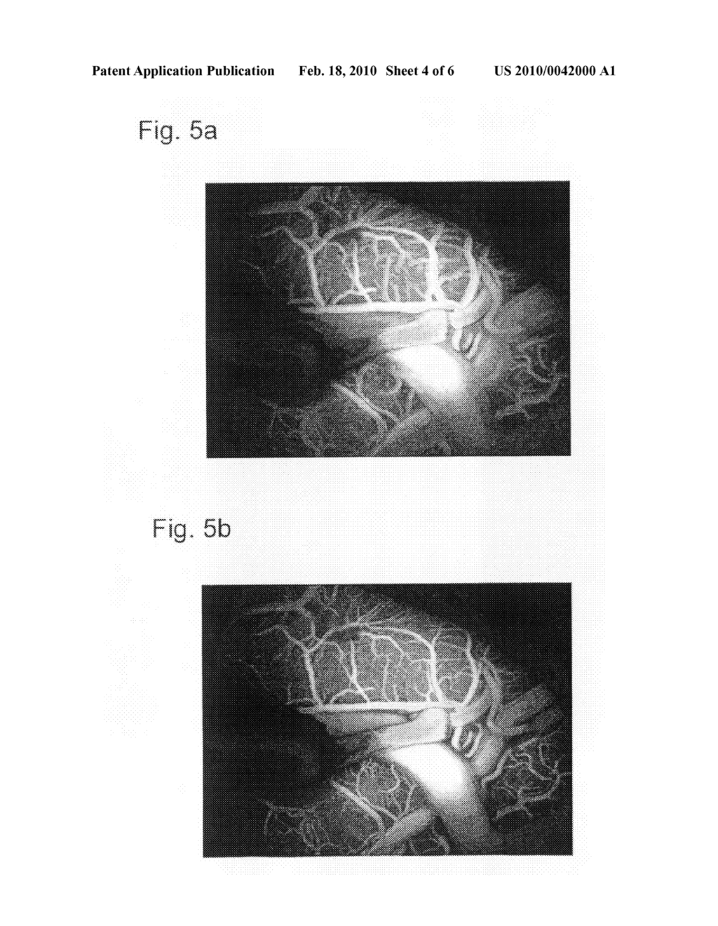 Method for correcting the image data that represent the blood flow - diagram, schematic, and image 05