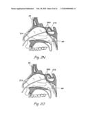 DEVICES, SYSTEMS AND METHODS USEABLE FOR TREATING SINUSITIS diagram and image