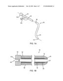 SLITTABLE OR REMOVABLE VALVES AND APPARATUS AND METHODS FOR MAKING AND USING THEM diagram and image