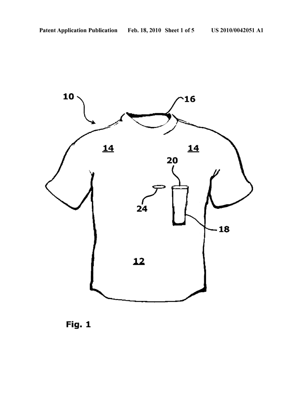 System and Method for Holding a Catheter Near a Patient's Body - diagram, schematic, and image 02