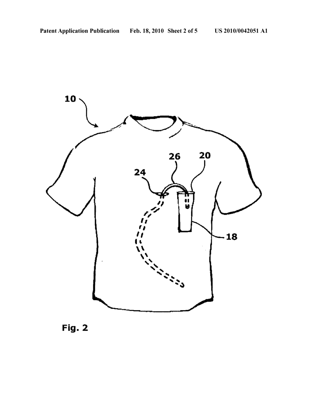 System and Method for Holding a Catheter Near a Patient's Body - diagram, schematic, and image 03