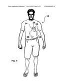 System and Method for Holding a Catheter Near a Patient s Body diagram and image