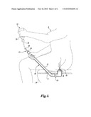 ENEMA DEVICE diagram and image