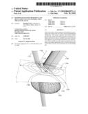 Method and System for Removal and Replacement of Lens Material fron the Lens of an Eye diagram and image