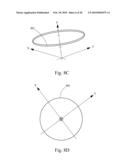 Method and System for Removal and Replacement of Lens Material fron the Lens of an Eye diagram and image