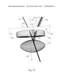 Method and System for Removal and Replacement of Lens Material fron the Lens of an Eye diagram and image