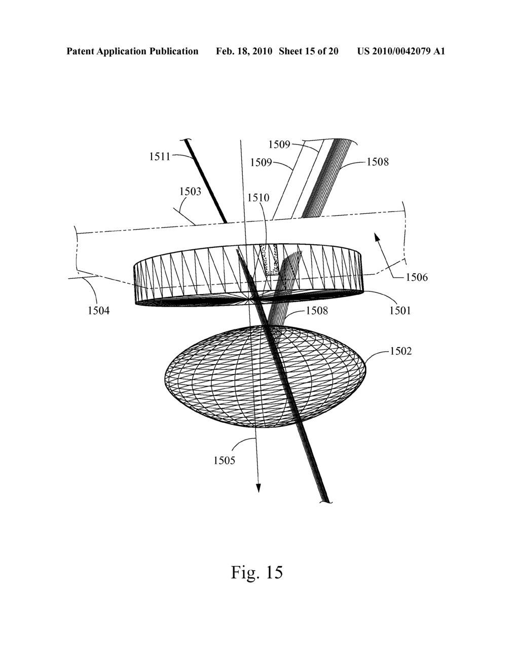 Method and System for Removal and Replacement of Lens Material fron the Lens of an Eye - diagram, schematic, and image 16