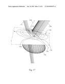 Method and System for Removal and Replacement of Lens Material fron the Lens of an Eye diagram and image