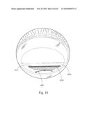 Method and System for Removal and Replacement of Lens Material fron the Lens of an Eye diagram and image