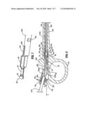 Vessel Sealing Instrument diagram and image