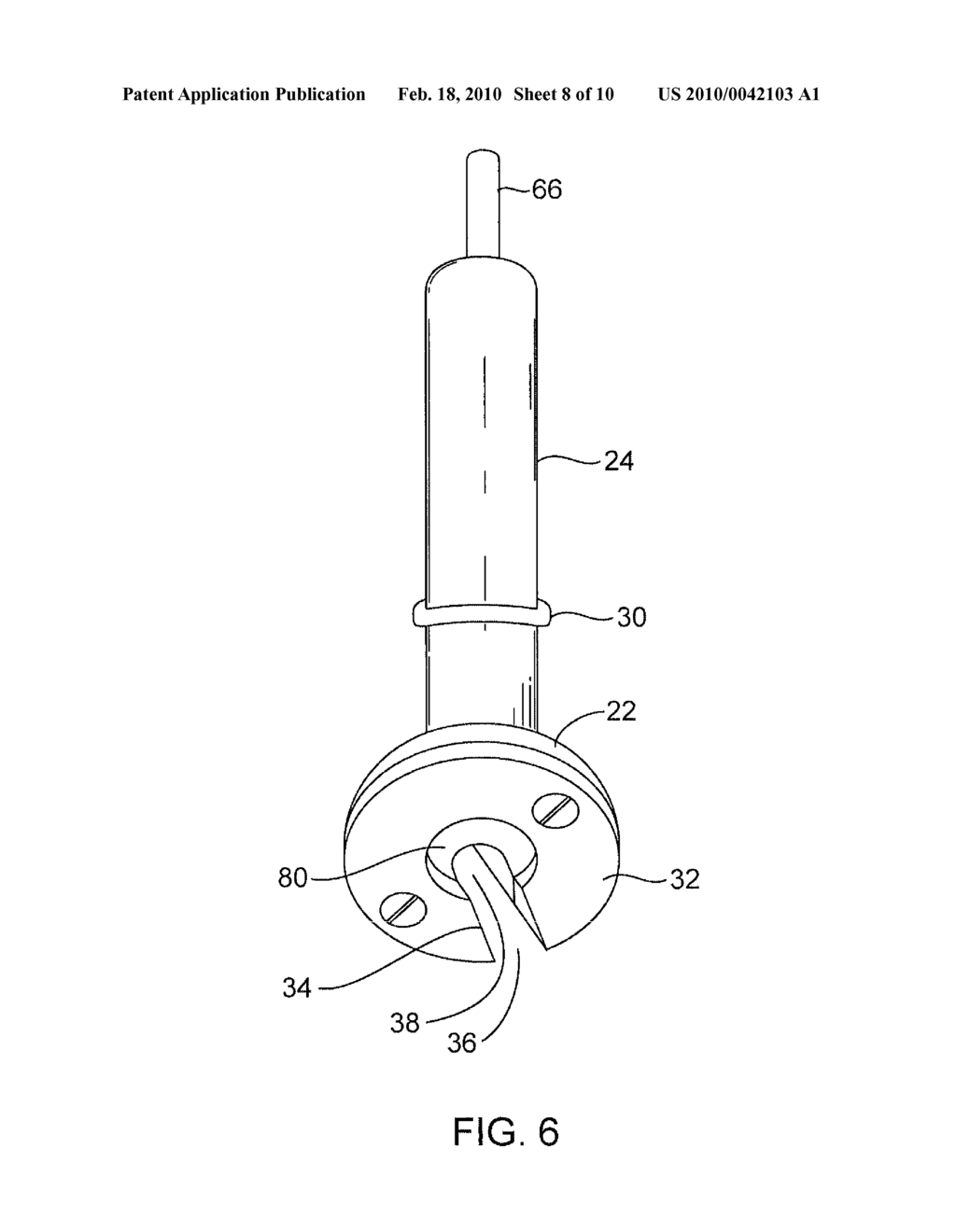 SYSTEMS AND METHODS FOR PROVIDING A BONE MILLING DEVICE - diagram, schematic, and image 09