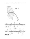 SURGICAL TOOLS AND COMPONENTS THEREOF diagram and image