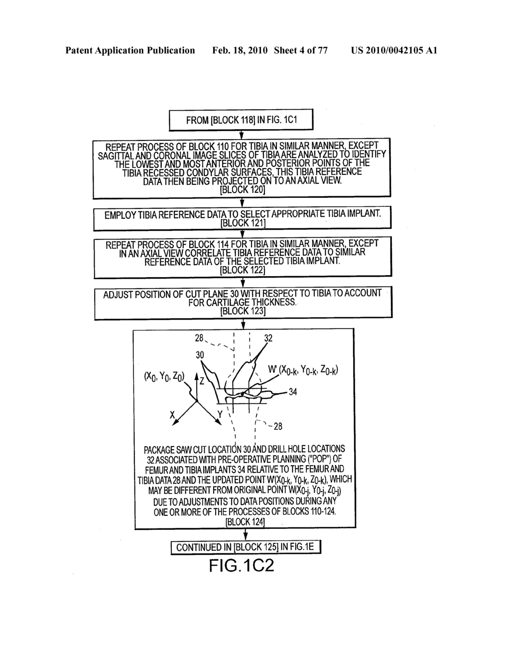 Arthroplasty system and related methods - diagram, schematic, and image 05