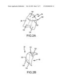 Arthroplasty system and related methods diagram and image