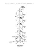 Arthroplasty system and related methods diagram and image