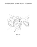 Arthroplasty system and related methods diagram and image