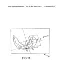 Arthroplasty system and related methods diagram and image