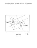 Arthroplasty system and related methods diagram and image