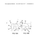 Arthroplasty system and related methods diagram and image