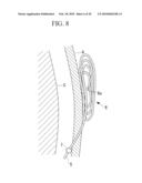 METHOD OF CARDIAC SURGERY, AND DEFIBRILLATION ELECTRODE, DEFIBRILLATOR, AND ENDOSCOPE APPARATUS FOR THE SAME diagram and image