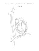 METHOD OF CARDIAC SURGERY, AND DEFIBRILLATION ELECTRODE, DEFIBRILLATOR, AND ENDOSCOPE APPARATUS FOR THE SAME diagram and image