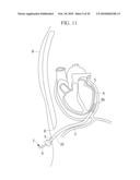 METHOD OF CARDIAC SURGERY, AND DEFIBRILLATION ELECTRODE, DEFIBRILLATOR, AND ENDOSCOPE APPARATUS FOR THE SAME diagram and image