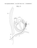 METHOD OF CARDIAC SURGERY, AND DEFIBRILLATION ELECTRODE, DEFIBRILLATOR, AND ENDOSCOPE APPARATUS FOR THE SAME diagram and image