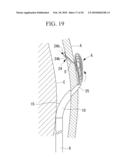 METHOD OF CARDIAC SURGERY, AND DEFIBRILLATION ELECTRODE, DEFIBRILLATOR, AND ENDOSCOPE APPARATUS FOR THE SAME diagram and image