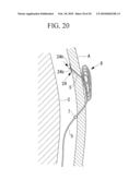 METHOD OF CARDIAC SURGERY, AND DEFIBRILLATION ELECTRODE, DEFIBRILLATOR, AND ENDOSCOPE APPARATUS FOR THE SAME diagram and image