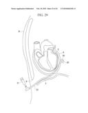 METHOD OF CARDIAC SURGERY, AND DEFIBRILLATION ELECTRODE, DEFIBRILLATOR, AND ENDOSCOPE APPARATUS FOR THE SAME diagram and image