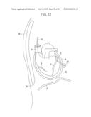 METHOD OF CARDIAC SURGERY, AND DEFIBRILLATION ELECTRODE, DEFIBRILLATOR, AND ENDOSCOPE APPARATUS FOR THE SAME diagram and image