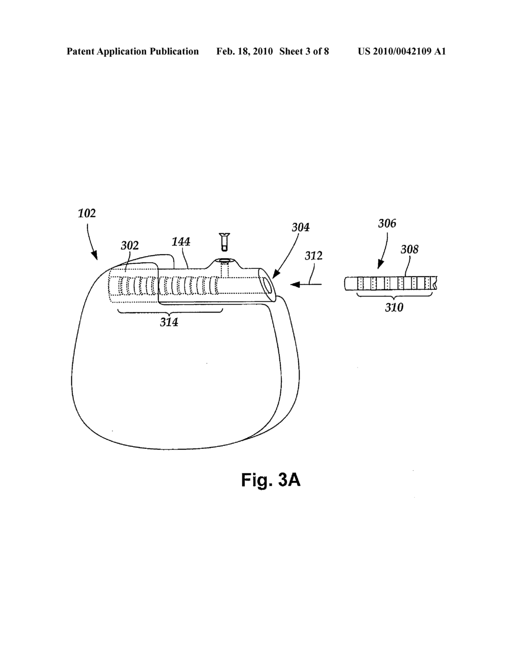 STYLET FOR GUIDING LEADS OF IMPLANTABLE ELECTRIC STIMULATION SYSTEMS AND METHODS OF MAKING AND USING - diagram, schematic, and image 04