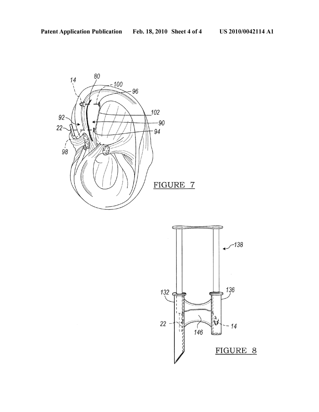 Apparatus for Performing Meniscus Repair - diagram, schematic, and image 05