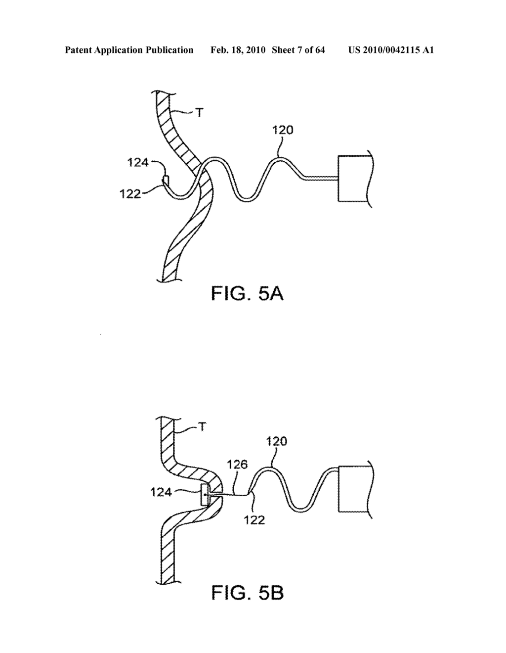 NEEDLE ASSEMBLY FOR TISSUE MANIPULATION - diagram, schematic, and image 08