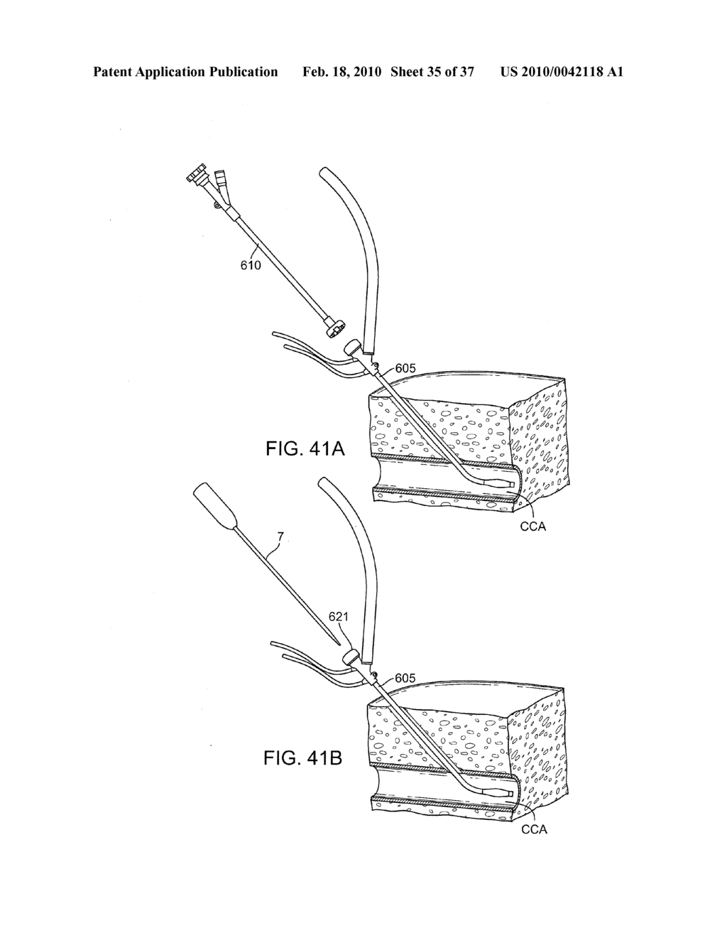 SUTURE DELIVERY DEVICE - diagram, schematic, and image 36