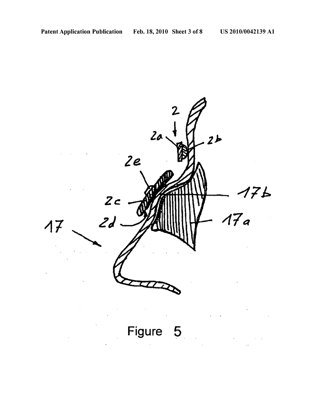 Device for reshaping bones - diagram, schematic, and image 04