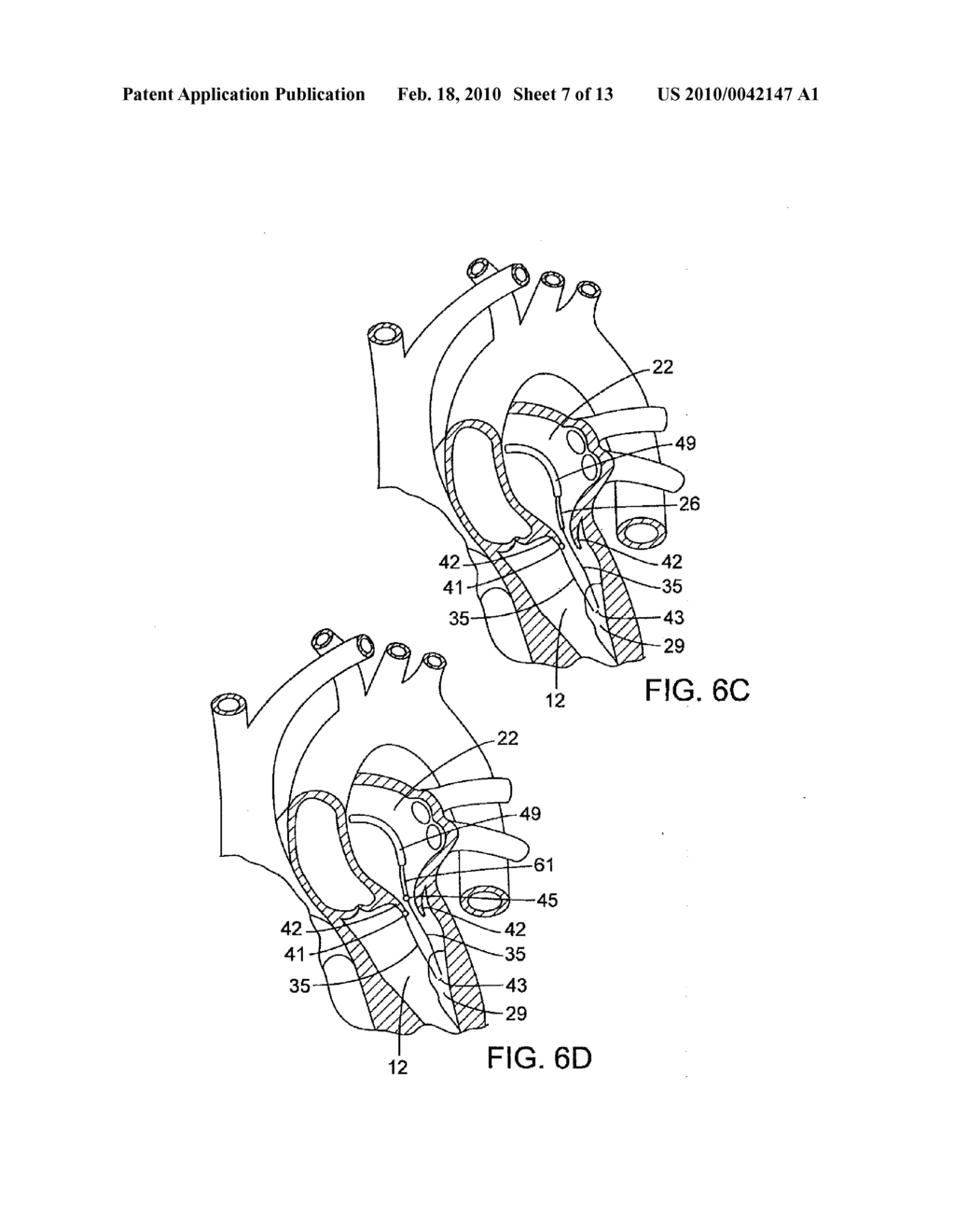 METHOD AND APPARATUS FOR REPAIRING OR REPLACING CHORDAE TENDINAE - diagram, schematic, and image 08