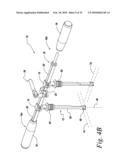 PELVIC OBLIQUITY CORRECTION INSTRUMENT diagram and image